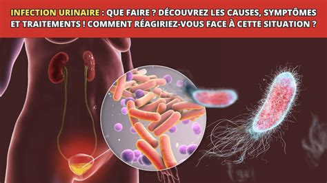 sodomie et infection urinaire|Infection urinaire: causes, symptômes, traitement et。